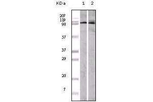 Western blot analysis using EphA1 mouse mAb against A549 (1) and Hela (2) cell lysate.
