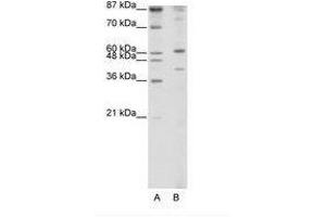 Image no. 1 for anti-REX4, RNA Exonuclease 4 Homolog (REXO4) (N-Term) antibody (ABIN202487) (REXO4 Antikörper  (N-Term))