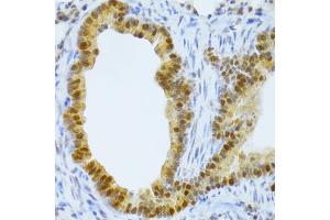 Immunohistochemistry of paraffin-embedded mouse lung using TAF1C Antibody (ABIN5974089) at dilution of 1/100 (40x lens). (TAF1C Antikörper)