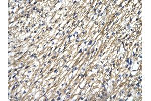 Rabbit Anti-STAT4 antibody Catalog Number: ARP33376  Paraffin Embedded Tissue: Human Heart cell Cellular Data: cardiac cell of renal tubule Antibody Concentration: 4. (STAT4 Antikörper  (N-Term))