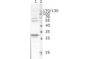 Western Blot testing of HIV-1 recombinant Nef protein. (HIV-1 Nef (AA 62-68) Antikörper)