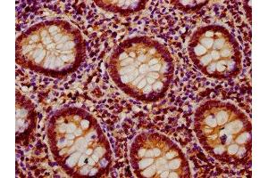 Immunohistochemistry (IHC) image for anti-Protein tyrosine Phosphatase, Non-Receptor Type 9 (PTPN9) (AA 221-339) antibody (ABIN7174121)