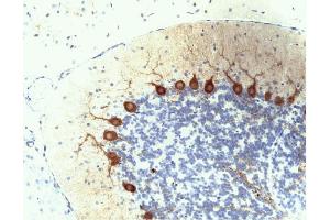 Purkinje Cells in rat cerebellum, formalin-fixed paraffin-embedded tissue, citrate pre-treatment, 40X (PKC delta Antikörper  (AA 114-289))
