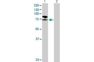 Western Blot analysis of SCNN1B expression in transfected 293T cell line by SCNN1B MaxPab polyclonal antibody. (SCNN1B Antikörper  (AA 1-640))