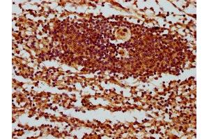IHC image of ABIN7169487 diluted at 1:400 and staining in paraffin-embedded human spleen tissue performed on a Leica BondTM system. (SH3BP1 Antikörper  (AA 161-266))