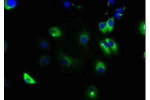 Immunofluorescence staining of MCF-7 cells with ABIN7161298 at 1:133, counter-stained with DAPI. (NOTCH2 Antikörper  (AA 59-250))