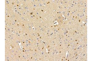 ASPA Antibody at 1/100 staining rat brain tissue by IHC-P.