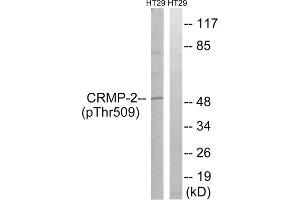 Western blot analysis of extracts from HT-29 cells, treated with heat shock, using CRMP2 (Phospho-Thr509) antibody. (DPYSL2 Antikörper  (pThr509))