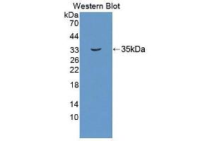 Western blot analysis of the recombinant protein. (UMPS Antikörper  (AA 205-480))