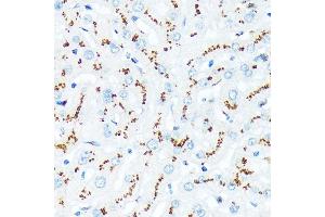 Immunohistochemistry of paraffin-embedded human liver using TGN46/TGOLN2 Rabbit mAb (ABIN7270875) at dilution of 1:100 (40x lens). (TGOLN2 Antikörper)