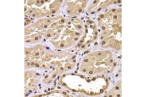 Immunohistochemistry of paraffin-embedded human kidney using CSRP2BP antibody at dilution of 1:100 (x400 lens).