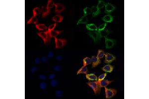 ABIN7094062 and ABIN7098106 staining Hela cells by IF/ICC.