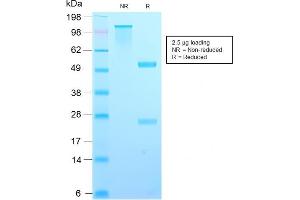 SDS-PAGE Analysis Purified TIMP2 Rabbit Recombinant Monoclonal Antibody (TIMP2/2488R). (Rekombinanter TIMP2 Antikörper  (N-Term))