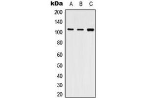 Western blot analysis of SERCA2 expression in THP1 (A), NIH3T3 (B), PC12 (C) whole cell lysates.