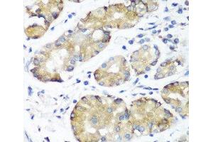 Immunohistochemistry of paraffin-embedded Human stomach using NOTCH2 Polyclonal Antibody at dilution of 1:100 (40x lens).