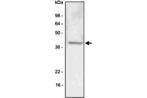 Western blot analysis of A-549 (lung carcinoma) cell lysate was resolved by SDS - PAGE , transferred to PVDF membrane and probed with LYVE1 monoclonal antibody , clone 4G1 (1 : 500)  . (LYVE1 Antikörper  (AA 25-235))