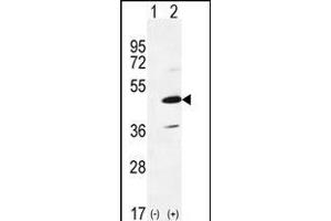 Western blot analysis of IRAK4 (arrow) using rabbit polyclonal IRAK4 Antibody (R20) (ABIN6243238 and ABIN6579012).