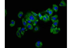 Immunofluorescence staining of HepG2 cells with ABIN7157495 at 1:133, counter-stained with DAPI. (KIR2DL1 Antikörper  (AA 162-267))