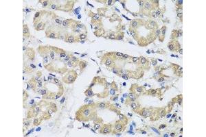 Immunohistochemistry of paraffin-embedded Human stomach using SCG3 Polyclonal Antibody at dilution of 1:100 (40x lens). (SCG3 Antikörper)