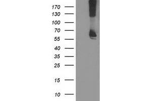 Western Blotting (WB) image for anti-Ribophorin 1 (RPN1) antibody (ABIN1500748) (RPN1 Antikörper)
