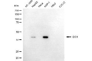 Western blotting analysis using IDO1 antibody (ABIN7799027).