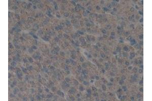 IHC-P analysis of Mouse Ovary Tissue, with DAB staining. (PLAU Antikörper  (AA 180-433))
