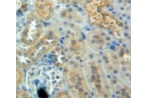 Used in DAB staining on fromalin fixed paraffin-embedded kidney tissue (CSTB Antikörper  (AA 2-98))