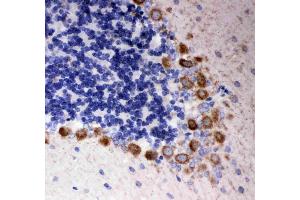 Anti- DISC1 antibody, IHC(P): Rat Cerebellum Tissue (DISC1 Antikörper  (Middle Region))