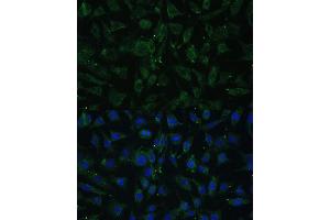 Immunofluorescence analysis of L929 cells using A Polyclonal Antibody (ABIN7265628) at dilution of 1:100 (40x lens).