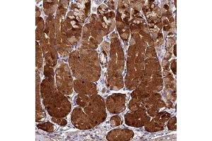 Immunohistochemical staining of human stomach upper with ST3GAL6 polyclonal antibody ( Cat # PAB28018 ) shows strong cytoplasmic positivity in glandular cells.