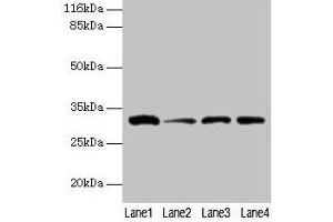 Western blot All lanes: GSTK1 antibody at 2 μg/mL Lane 1: 293T whole cell lysate Lane 2: Hela whole cell lysate Lane 3: A431 whole cell lysate Lane 4: COLO205 whole cell lysate Secondary Goat polyclonal to rabbit IgG at 1/10000 dilution Predicted band size: 26, 32, 25, 21 kDa Observed band size: 32 kDa