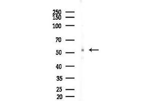 Western blot analysis of lysates from EC304 cells, using Phospho-Chk1 (Ser345) Antibody at 1/1000 dilution.
