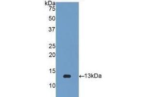 Detection of Recombinant b2M, Human using Polyclonal Antibody to Beta-2-Microglobulin (b2M) (beta-2 Microglobulin Antikörper  (AA 22-119))