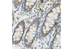 Immunohistochemistry of paraffin-embedded human colon using DEFB132 antibody (ABIN6293281) at dilution of 1:100 (40x lens).