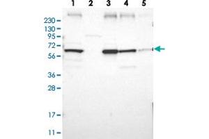 Western blot analysis of Lane 1: RT-4, Lane 2: Human Plasma, Lane 3: U-251 MG, Lane 4: Liver, Lane 5: Tonsil with CLCC1 polyclonal antibody  at 1:250-1:500 dilution. (CLCC1 Antikörper)