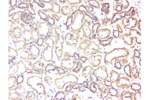 Formalin-fixed and paraffin embedded human kidney labeled with Rabbit Anti-5HT3B receptor Polyclonal Antibody, Unconjugated  at 1:200 followed by conjugation to the secondary antibody and DAB staining