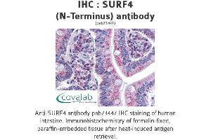 Image no. 2 for anti-Surfeit 4 (SURF4) (N-Term) antibody (ABIN1739778)