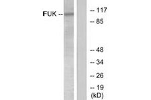 Western blot analysis of extracts from COS7 cells, treated with insulin 0. (FUK Antikörper  (AA 11-60))
