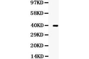 Western blot analysis of TRIB2 expression in SW620 whole cell lysates (lane 1). (TRIB2 Antikörper  (Middle Region))