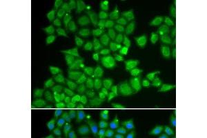 Immunofluorescence analysis of U2OS cells using PDE1B Polyclonal Antibody (PDE1B Antikörper)