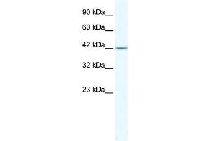 WB Suggested Anti-ZNF70 Antibody Titration:  5. (ZNF70 Antikörper  (N-Term))