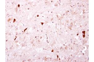 IHC-P Image BTD antibody [N3C3] detects BTD protein at cytosol on mouse hind brain by immunohistochemical analysis.