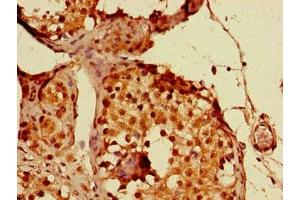 Immunohistochemistry of paraffin-embedded human testis tissue using ABIN7144480 at dilution of 1:100 (PPP1R13B Antikörper  (AA 375-675))