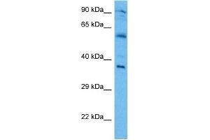 Host:  Mouse  Target Name:  IRF1  Sample Tissue:  Mouse Brain  Antibody Dilution:  1ug/ml (IRF1 Antikörper  (Middle Region))