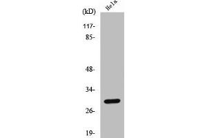 Western Blot analysis of HeLa cells using Cleaved-Cathepsin L1 HC (T288) Polyclonal Antibody (Cathepsin L Antikörper  (Cleaved-Thr288))