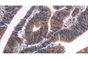 Immunohistochemistry (Paraffin-embedded Sections) (IHC (p)) image for anti-Nuclear Factor of Activated T-Cells, Cytoplasmic, Calcineurin-Dependent 3 (NFATC3) antibody (ABIN7235382)