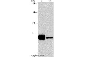 Western blot analysis of K562 and mouse brain tissue, using PIP4K2A Polyclonal Antibody at dilution of 1:1150 (PIP4K2A Antikörper)