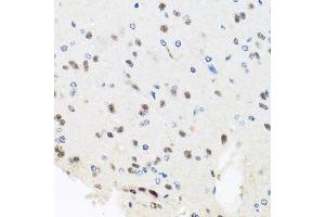 Immunohistochemistry of paraffin-embedded rat brain using PRPF8 antibody. (PRPF8 Antikörper  (AA 1-100))
