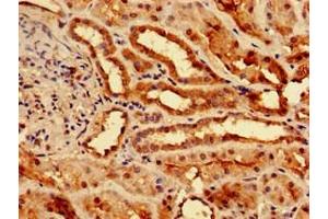 Immunohistochemistry of paraffin-embedded human kidney tissue using ABIN7173369 at dilution of 1:100 (Slc25a1 Antikörper  (AA 144-182))