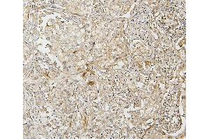 IHC analysis of IRF3 using anti-IRF3 antibody (ABIN7601885).